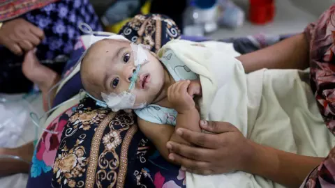 बङ्गलादेशमा दादुरा महामारी : ५०० भन्दा बढी बालबालिकाको मृत्यु